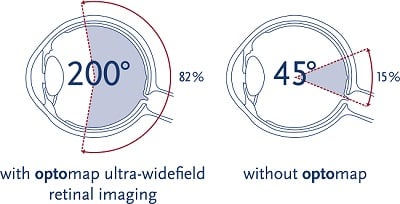 Comparison of imaging with and without Optomap. 